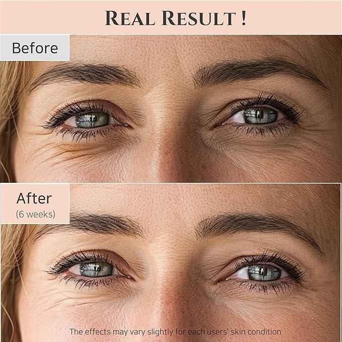 Beauty of Joseon Revive Eye Serum 30ml