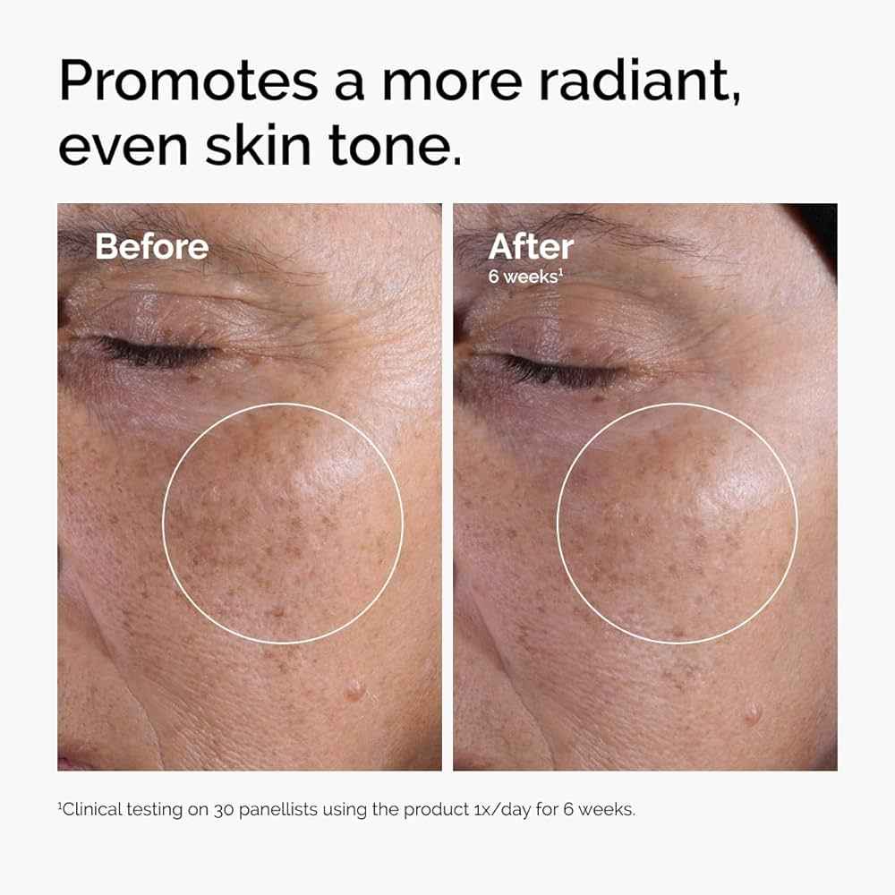 The Ordinary Glycolic Acid 7% Exfoliating Toner, Brightening and Smoothing Daily Toner for More Even-Looking Skin Tone 240ml