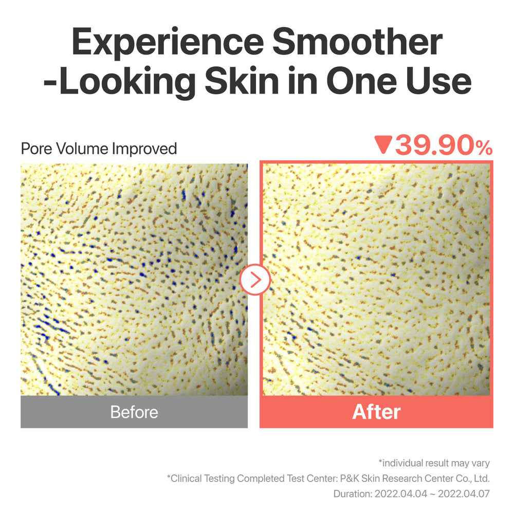 No.3 Tingle-Pore Softening Sheet Mask (5 Sheets)