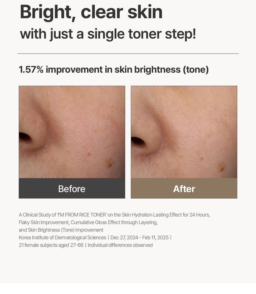 I'm From Rice Toner 150ml