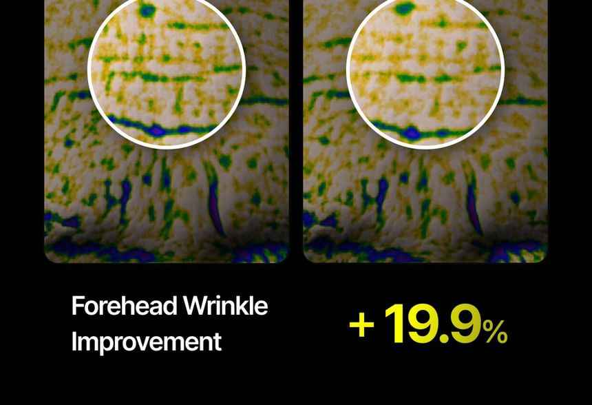 celimax - The Vita-A Retinal Shot Tightening Dual Cream