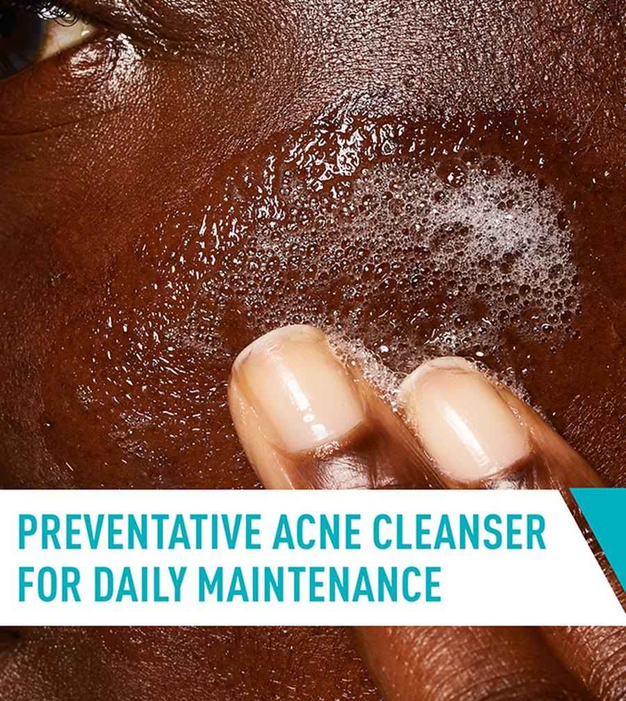 Cerave-Acne Control Cleanser 237ml